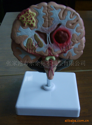 精準(zhǔn)教學(xué)，賦能未來(lái)——高端腦中風(fēng)病理模型助力醫(yī)學(xué)教育革新